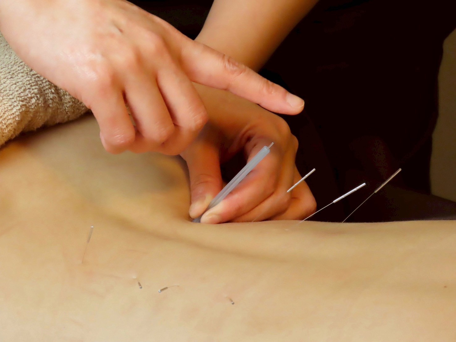 全身調整 鍼灸・ほぐしコース